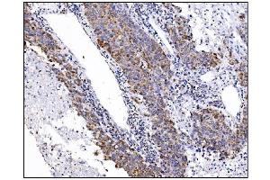 IHC analysis of DLGAP1 using anti-DLGAP1 antibody (ABIN7600257). (DLGAP1 抗体  (AA 17-319))