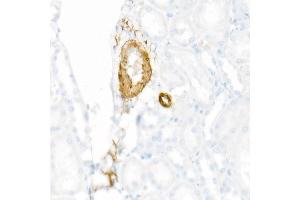 Immunohistochemistry of paraffin-embedded Rat kidney using using SMMHC/MYH11 antibody (ABIN7268745) at dilution of 1:8100 (40x lens). (MYH11 抗体)