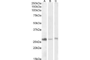 ABIN768557 (1 μg/mL) staining of Human Liver (A), Kidney (B) and -Mouse Liver (C) lysate (35 μg protein in RIPA buffer). (DNAJB9 抗体  (AA 61-75))