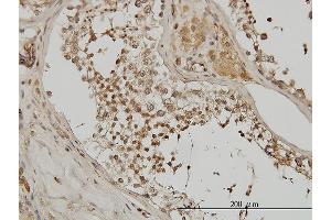 Immunoperoxidase of monoclonal antibody to ACTN4 on formalin-fixed paraffin-embedded human testis. (alpha Actinin 4 抗体  (AA 592-701))