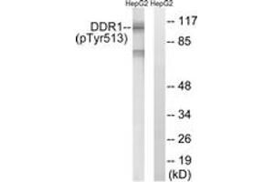 Western blot analysis of extracts from HepG2 cells treated with Na3VO4 0. (DDR1 抗体  (pTyr513))