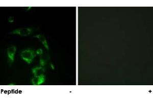 Immunofluorescence analysis of HeLa cells, using EIF4G1 polyclonal antibody . (EIF4G1 抗体)
