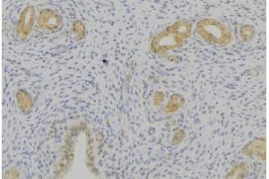 ABIN6276769 at 1/100 staining Human uterus tissue by IHC-P. (Prolactin 抗体  (Internal Region))