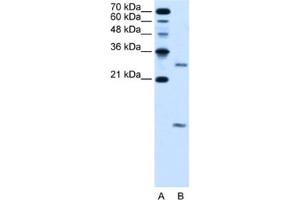 Western Blotting (WB) image for anti-Vacuolar H+-ATPase Homolog (VMA21) antibody (ABIN2463979) (VMA21 抗体)