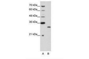 Image no. 1 for anti-CPX Chromosome Region, Candidate 1 (CPXCR1) (N-Term) antibody (ABIN202196)
