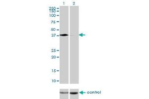 Western blot analysis of PCBP2 over-expressed 293 cell line, cotransfected with PCBP2 Validated Chimera RNAi (Lane 2) or non-transfected control (Lane 1). (PCBP2 抗体  (AA 1-362))