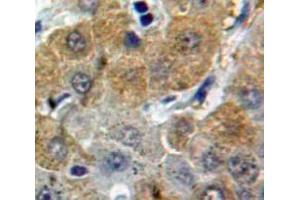 Used in DAB staining on fromalin fixed paraffin-embedded Liver tissue (Afamin 抗体  (AA 211-403))