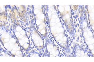 Immunohistochemistry (IHC) image for anti-Peptidylprolyl Isomerase A (Cyclophilin A) (PPIA) (AA 2-164) antibody (ABIN7432967)
