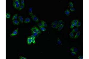 Immunofluorescent analysis of HepG2 cells using ABIN7173071 at dilution of 1:100 and Alexa Fluor 488-congugated AffiniPure Goat Anti-Rabbit IgG(H+L) (TMEM14B 抗体  (AA 1-114))