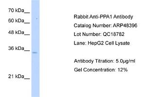 WB Suggested Anti-PPA1 Antibody   Titration: 5. (Pyrophosphatase (Inorganic) 1 (PPA1) (N-Term) 抗体)
