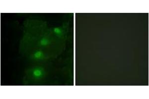 Immunofluorescence analysis of HeLa cells, using ALX3 Antibody. (ALX3 抗体  (AA 171-220))