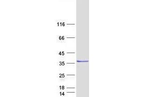 Western Blotting (WB) image for Zinc Finger, MYND-Type Containing 19 (ZMYND19) protein (Myc-DYKDDDDK Tag) (ABIN2735916)