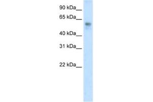 Western Blotting (WB) image for anti-BTB (POZ) Domain Containing 3 (BTBD3) antibody (ABIN2461861) (BTBD3 抗体)