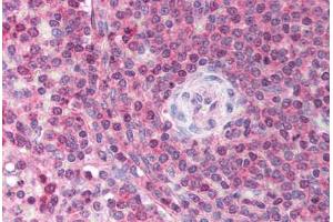 Human Spleen (formalin-fixed, paraffin-embedded) stained with USP39 antibody ABIN213731 at 2. (USP39 抗体  (N-Term))