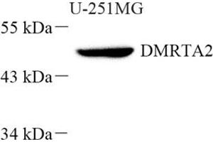 Western blot analysis of DMRTA2 (ABIN7073753) at dilution of 1: 500 (DMRTA2 抗体)
