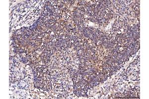 IHC analysis of ENO1 using anti-ENO1 antibody (ABIN7601902).