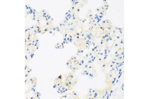 Immunohistochemistry of paraffin-embedded rat lung using NFU1 antibody at dilution of 1:200 (40x lens).