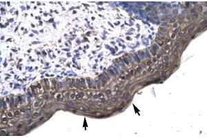 Human Spermatophore; KIN antibody - middle region in Human Spermatophore cells using Immunohistochemistry (KIN 抗体  (Middle Region))
