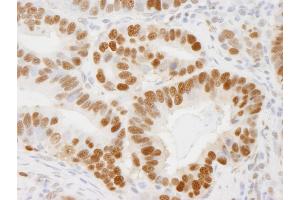 Immunohistochemistry (IHC) image for anti-Proliferating Cell Nuclear Antigen (PCNA) (C-Term) antibody (ABIN7448997)