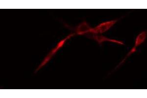 ABIN6274540 staining LOVO cells by IF/ICC. (MLX 抗体  (Internal Region))