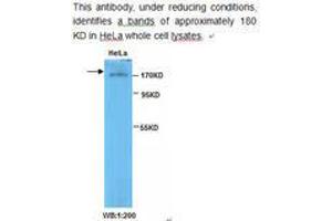 Image no. 1 for anti-Topoisomerase (DNA) II beta 180kDa (TOP2B) antibody (ABIN790819) (TOP2B 抗体)