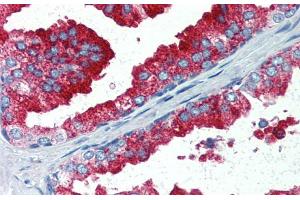 Immunohistochemistry with Human Prostate lysate tissue at an antibody concentration of 5. (YAP1 抗体  (C-Term))