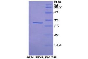 SDS-PAGE (SDS) image for Salt-Inducible Kinase 2 (SIK2) (AA 674-916) protein (His tag) (ABIN1878335)