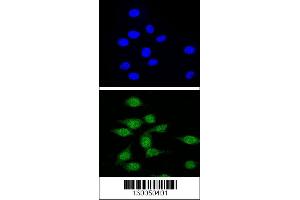 Confocal immunofluorescent analysis of AIRE Antibody with 293 cell followed by Alexa Fluor 488-conjugated goat anti-rabbit lgG (green). (AIRE 抗体  (AA 64-92))
