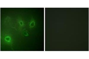 Immunofluorescence analysis of COS7 cells, using InsP3R1 (Ab-1598/1588) Antibody. (ITPR1 抗体  (AA 1566-1615))