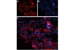 Immunohistochemistry (IHC) image for anti-Transient Receptor Potential Cation Channel, Subfamily V, Member 4 (TRPV4) (AA 647-662), (Extracellular) antibody (ABIN7043852)