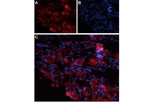 Expression of TRPV4 in rat DRG - Immunohistochemical staining of rat dorsal root ganglion (DRG) frozen sections using Anti-TRPV4 (extracellular) Antibody (ABIN7043852, ABIN7044071 and ABIN7044072). (TRPV4 抗体  (3rd Extracellular Loop))
