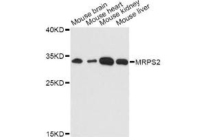 Western blot analysis of extracts of various cell lines, using MRPS2 antibody (ABIN6293851) at 1:3000 dilution. (MRPS2 抗体)