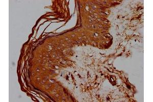 Immunohistochemistry (IHC) image for anti-CD44 (CD44) (AA 21-220) antibody (ABIN7147160)