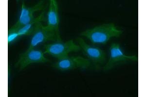 IF analysis of AKR1D1 using anti-AKR1D1 antibody (ABIN7602975).