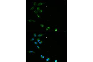 Immunofluorescence analysis of MCF-7 cells using HFE antibody. (HFE 抗体)