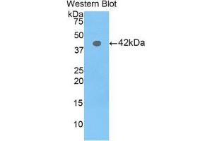 Western blot analysis of the recombinant protein. (Profilin 3 抗体  (AA 1-132))