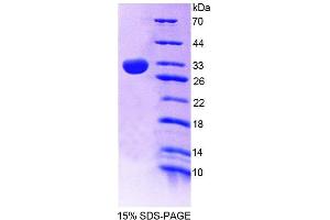 SDS-PAGE analysis of Mouse SPR Protein. (SPR 蛋白)