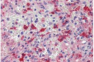 Spleen, Human: Formalin-Fixed, Paraffin-Embedded (FFPE) (HMOX1 抗体)