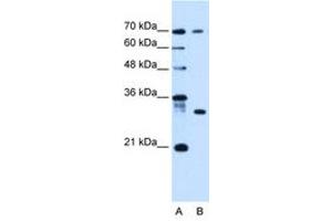 Image no. 1 for anti-ATPase, H+ Transporting, Lysosomal Accessory Protein 1-Like (ATP6AP1L) (C-Term) antibody (ABIN6736678) (ATP6AP1L 抗体  (C-Term))