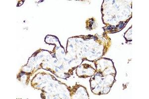 Immunohistochemistry of paraffin-embedded Human placenta using HSD17B1 Polyclonal Antibody at dilution of 1:100 (40x lens). (HSD17B1 抗体)