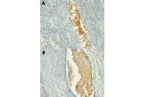 Immunohistochemical staining (Formalin-fixed paraffin-embedded sections) of human tonsil (A) and human placenta (B) with AMPD3 monoclonal antibody, clone AMPD3/901 . (AMPD3 抗体)