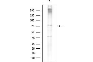 anti-Solute Carrier Family 22 Member 6 (SLC22A6) (C-Term) antibody