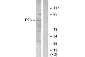 Western blot analysis of extracts from K562 cells, using p73 (Ab-99) Antibody. (Tumor Protein p73 抗体  (AA 66-115))