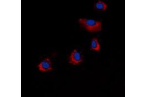 Immunofluorescent analysis of ARRDC4 staining in COLO205 cells. (ARRDC4 抗体  (Center))