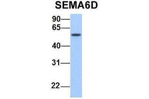 Western Blotting (WB) image for anti-Sema Domain, Transmembrane Domain (TM), and Cytoplasmic Domain, (Semaphorin) 6D (SEMA6D) (N-Term) antibody (ABIN2783810)