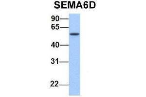Host:  Rabbit  Target Name:  SEMA6D  Sample Type:  Human Fetal Lung  Antibody Dilution:  1. (SEMA6D 抗体  (N-Term))