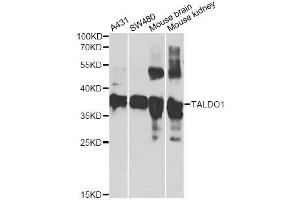 Western blot analysis of extracts of various cell lines, using TALDO1 antibody. (TALDO1 抗体  (AA 1-337))