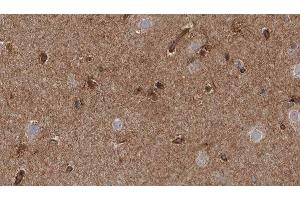 Immunohistochemistry (IHC) image for anti-Transient Receptor Potential Cation Channel, Subfamily M, Member 2 (TRPM2) (C-Term) antibody (ABIN6265756)