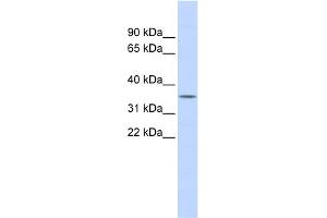 WB Suggested Anti-FCN1 Antibody Titration: 0. (FCN1 抗体  (Middle Region))