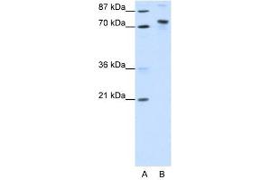 KIAA0737 antibody (20R-1215) used at 0. (TOX4 抗体  (N-Term))